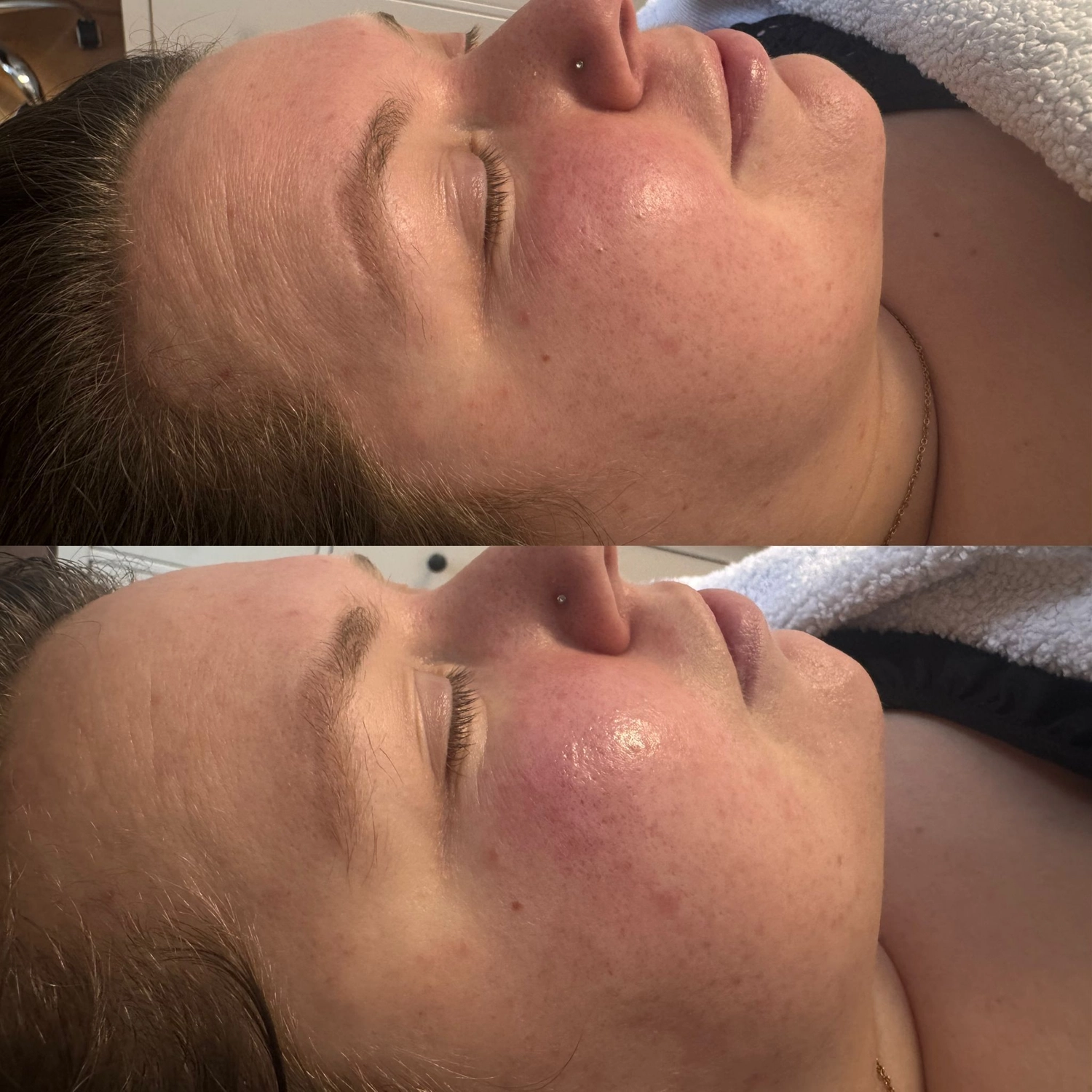 El barbero MB - Haar- und Hautpflegebehandlungen -  Aquafacial