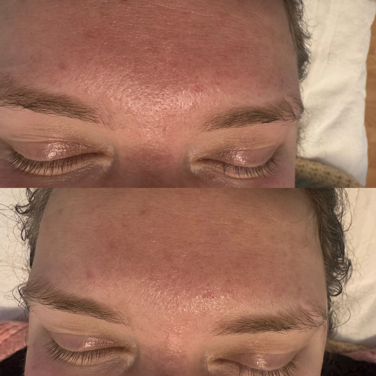 El barbero MB - Haar- und Hautpflegebehandlungen -  Aquafacial