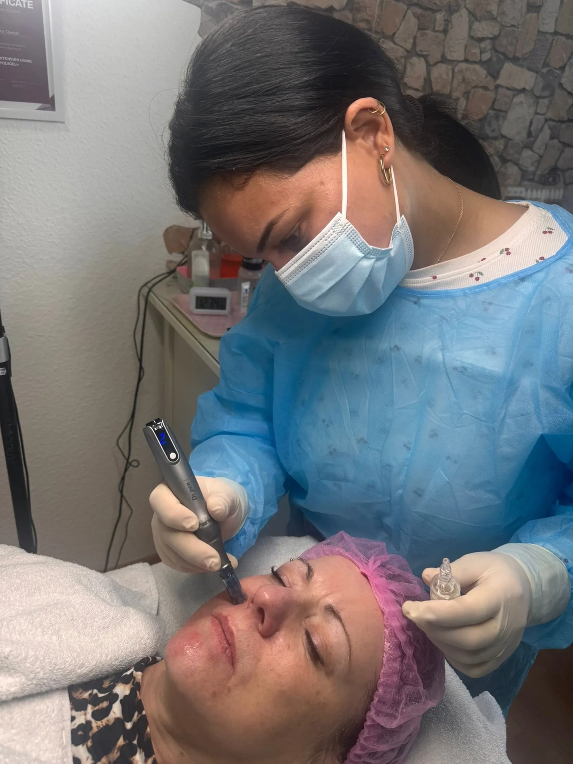 El barbero MB - Haar- und Hautpflegebehandlungen - Eine Kosmetikerin in blauem Schutzkittel, Mundschutz und Handschuhen führt eine Mikroneedling- oder Permanent-Make-up-Behandlung im Gesicht einer Kundin durch.